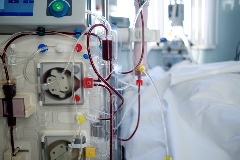 intensive care emergency room with hemodialysis machine hemofiltration procedure patient critical stance (1)
